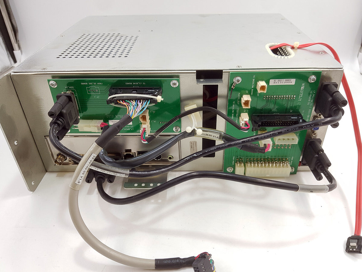 CHISON i3 Digital Color Doppler Ultrasound Computer