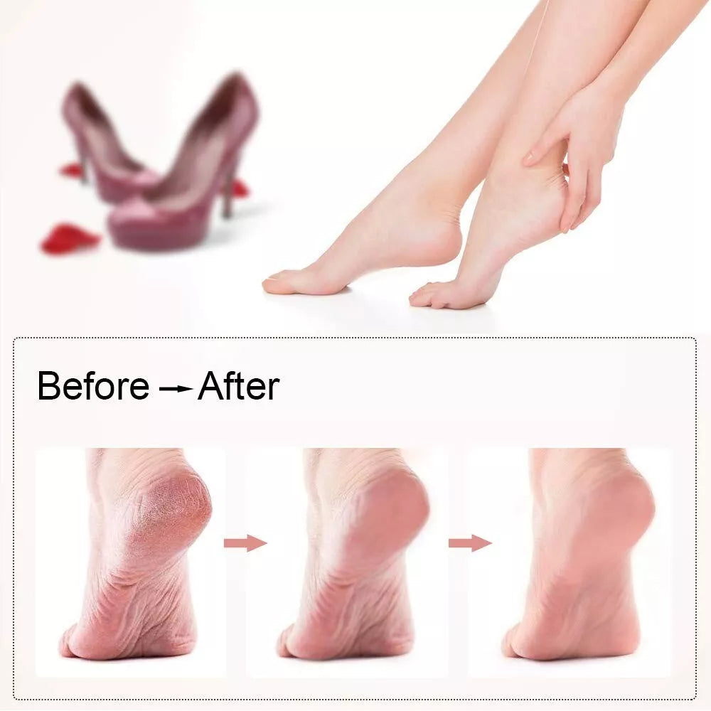 Rechargeable Electric Callus Remover with LED Pedicure Tool